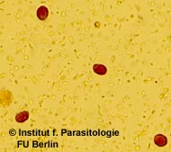 Giardien zusten im kot. Giardien zyste. Opisthorchiasis és lamblia Giardien zysten im kot