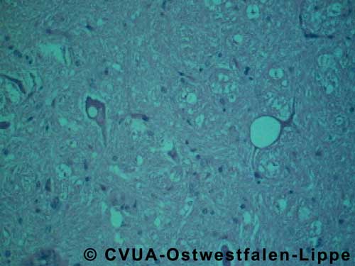 Typische spongiforme Ver�nderungen der Gehirnsubstanz bei BSE
